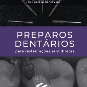 Preparos dentários para restaurações semidiretas