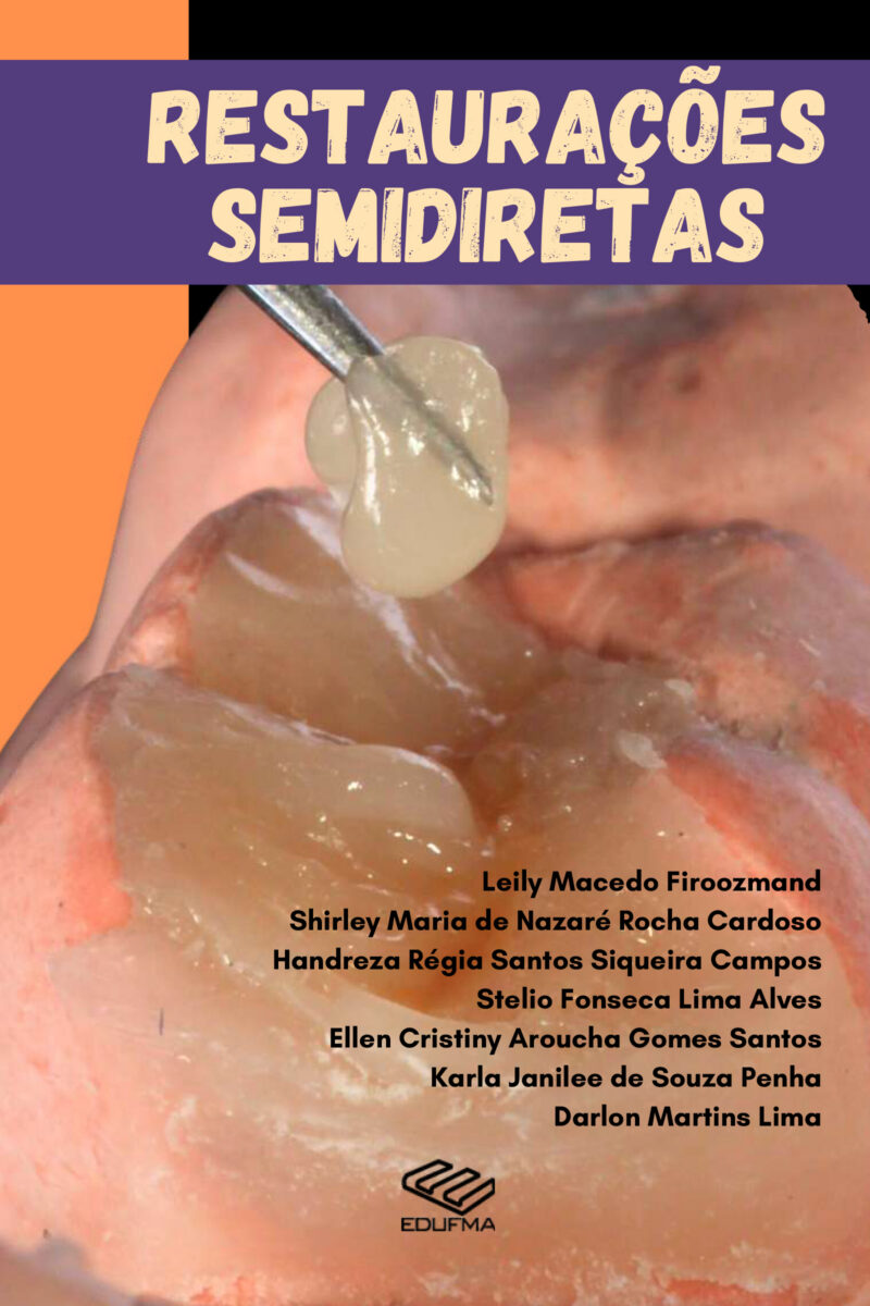 Restaurações semidiretas