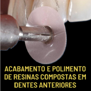 Acabamento e polimento de resinas compostas em dentes anteriores