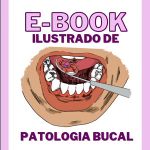 E-book ilustrado de patologia bucal