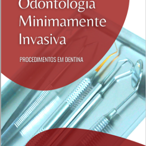 Odontologia minimamente invasiva: procedimentos em dentina
