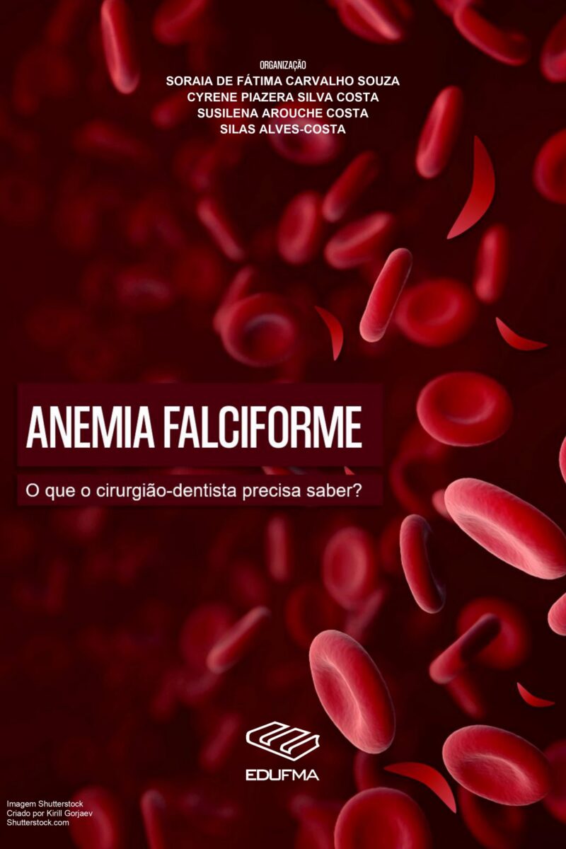 Anemia falciforme: o que o cirurgião-dentista precisa saber?
