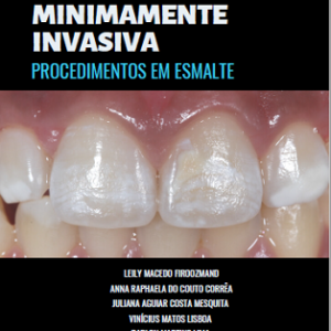 Odontologia minimamente invasiva : procedimentos em esmalte