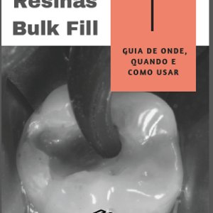 Resinas bulk fill : guia de onde, quando e como usar