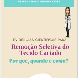 Evidências científicas para remoção seletiva do tecido cariado: por que, quando e como?