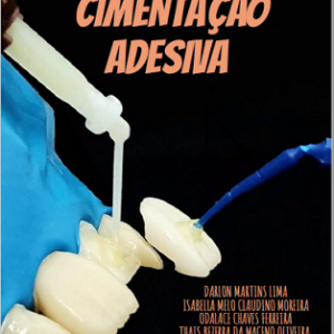 Cimentação adesiva