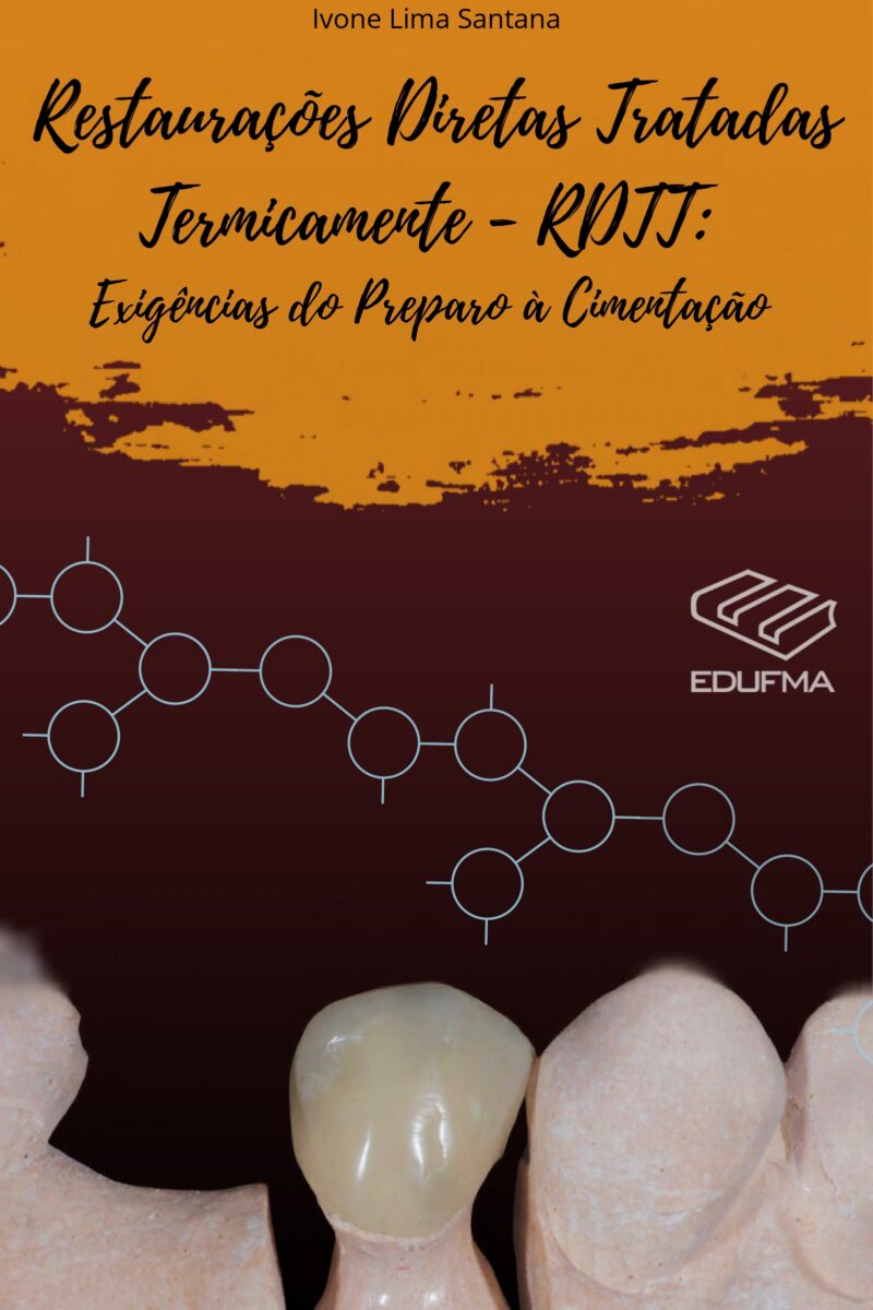 Restaurações Diretas Tratadas Termicamente – RDTT: Exigências do Preparo à Cimentação